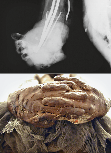 degas-littledancer-radiograph-hands