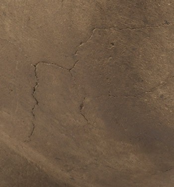 thumb-drying-cracks-on-stomach