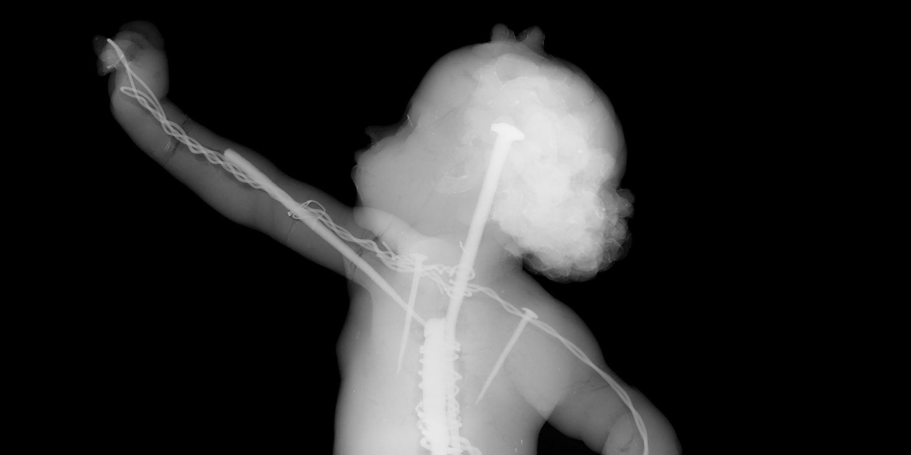 X-Ray of Verricchio's Putto